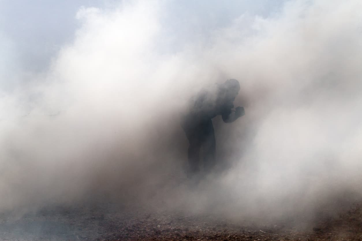 Fire Damage 101: How Fire and Smoke Affect the Skin